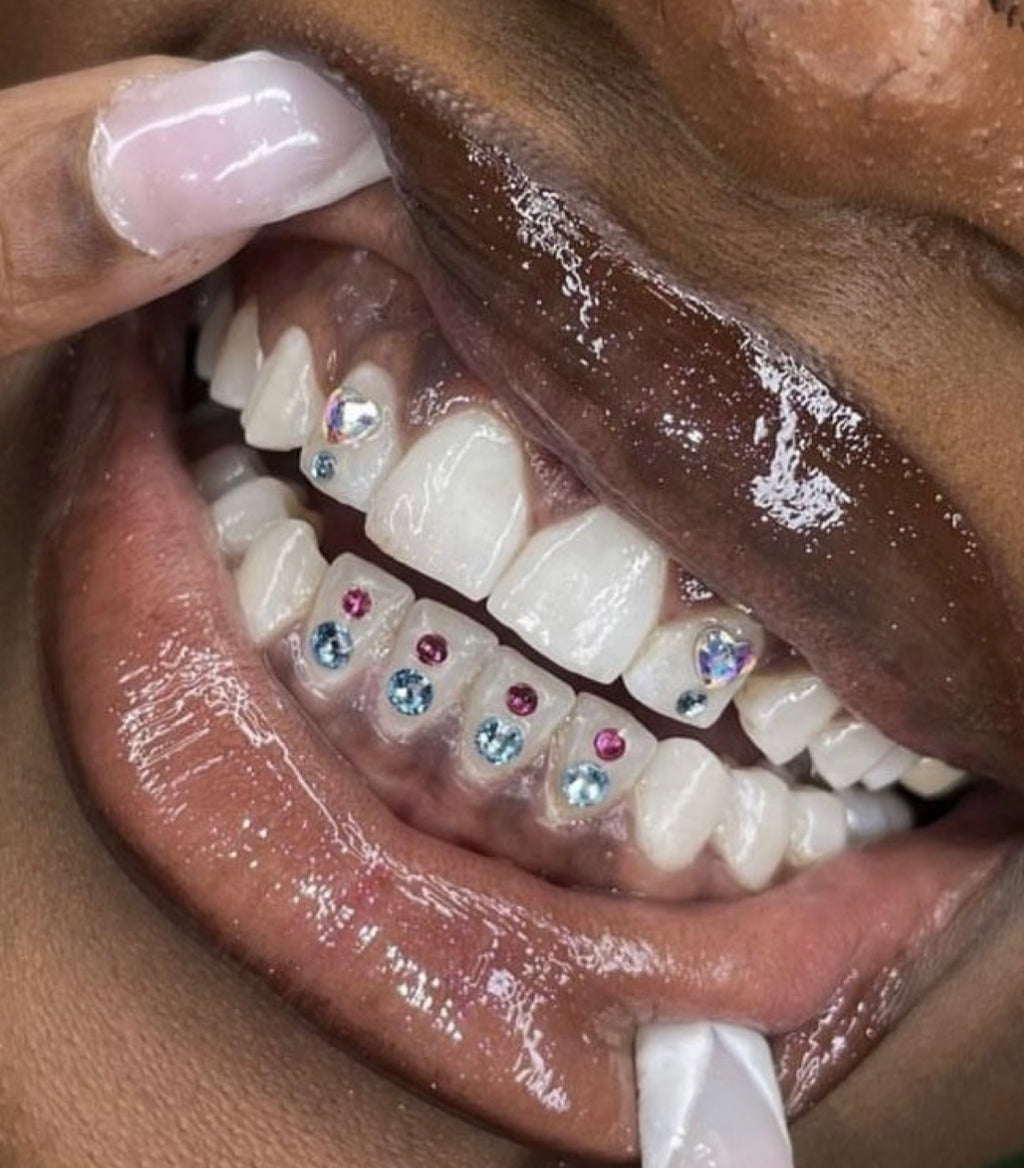 Tooth Gems