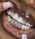 Tooth Gems