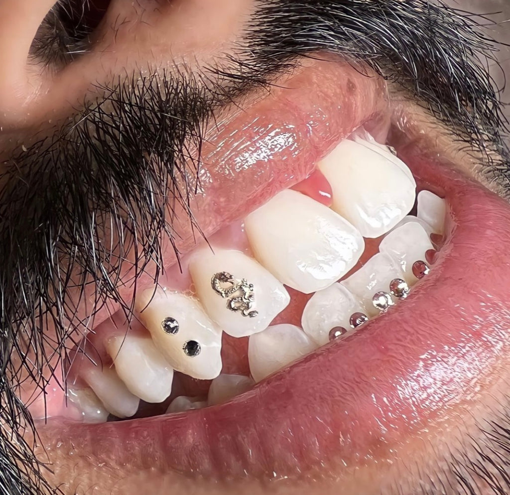 Tooth Gems